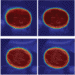 Scale-aware Auto-context-guided Fetal US Segmentation with Structured Random Forests