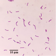 Screening of antibacterial activities of Bacillus spp. isolated from ...