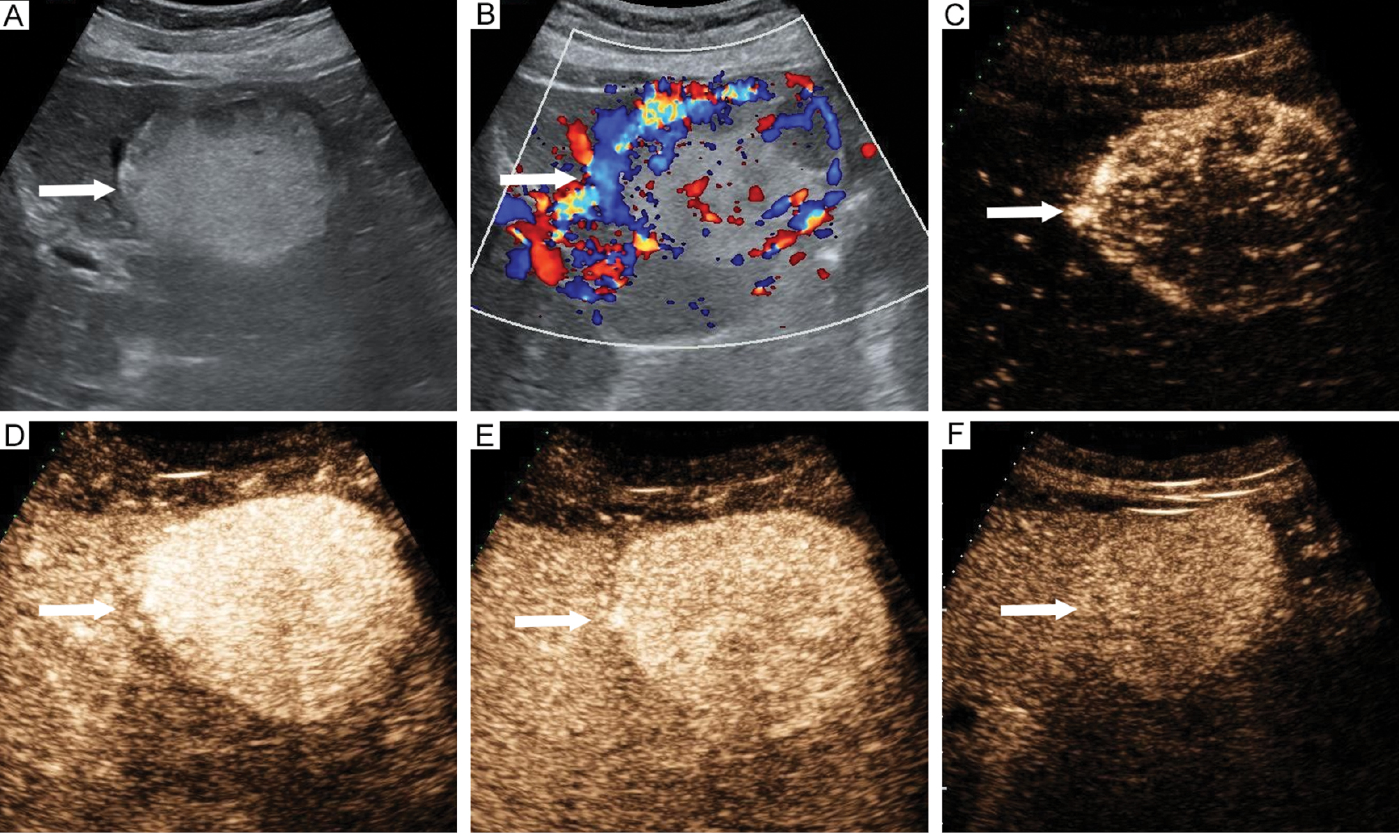 Next follows the figure caption