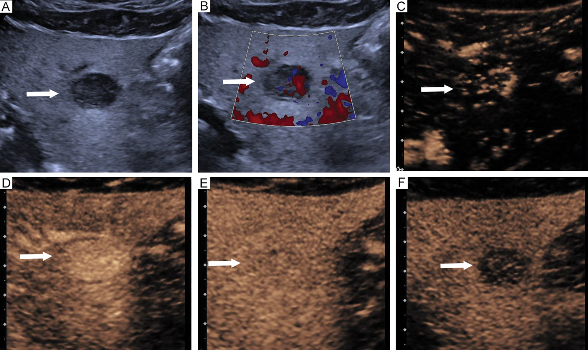 Next follows the figure caption