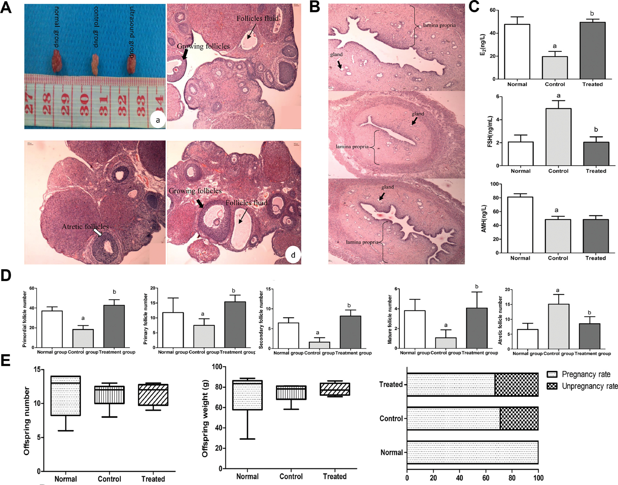 Next follows the figure caption