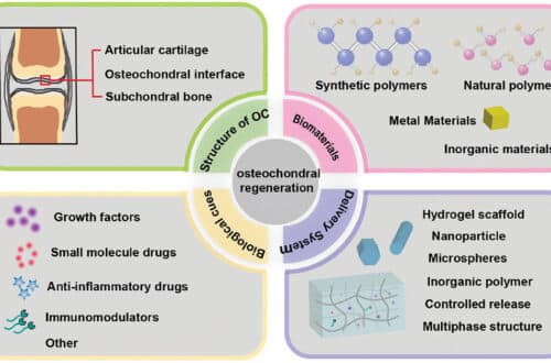 Drug delivery systems