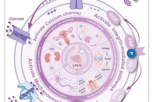 Low-intensity Pulsed Ultrasound