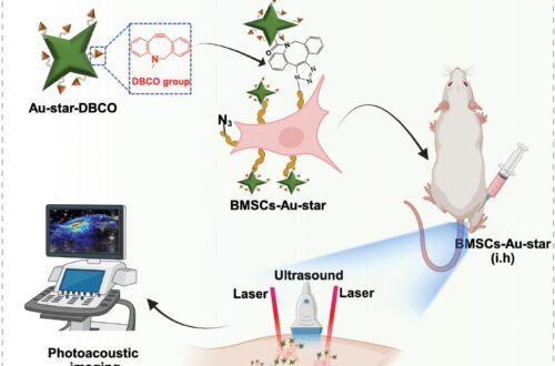 Photoacoustic imaging