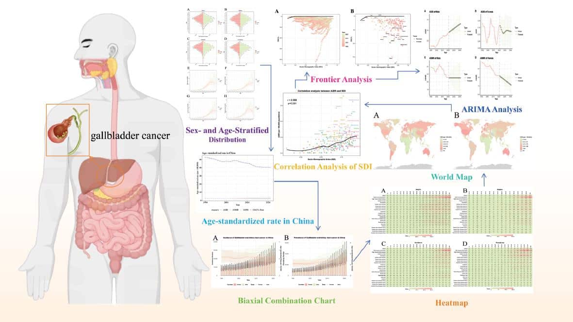 Trends in Gallbladder and Biliary Tract Cancer Global Burden (1990–2021 ...